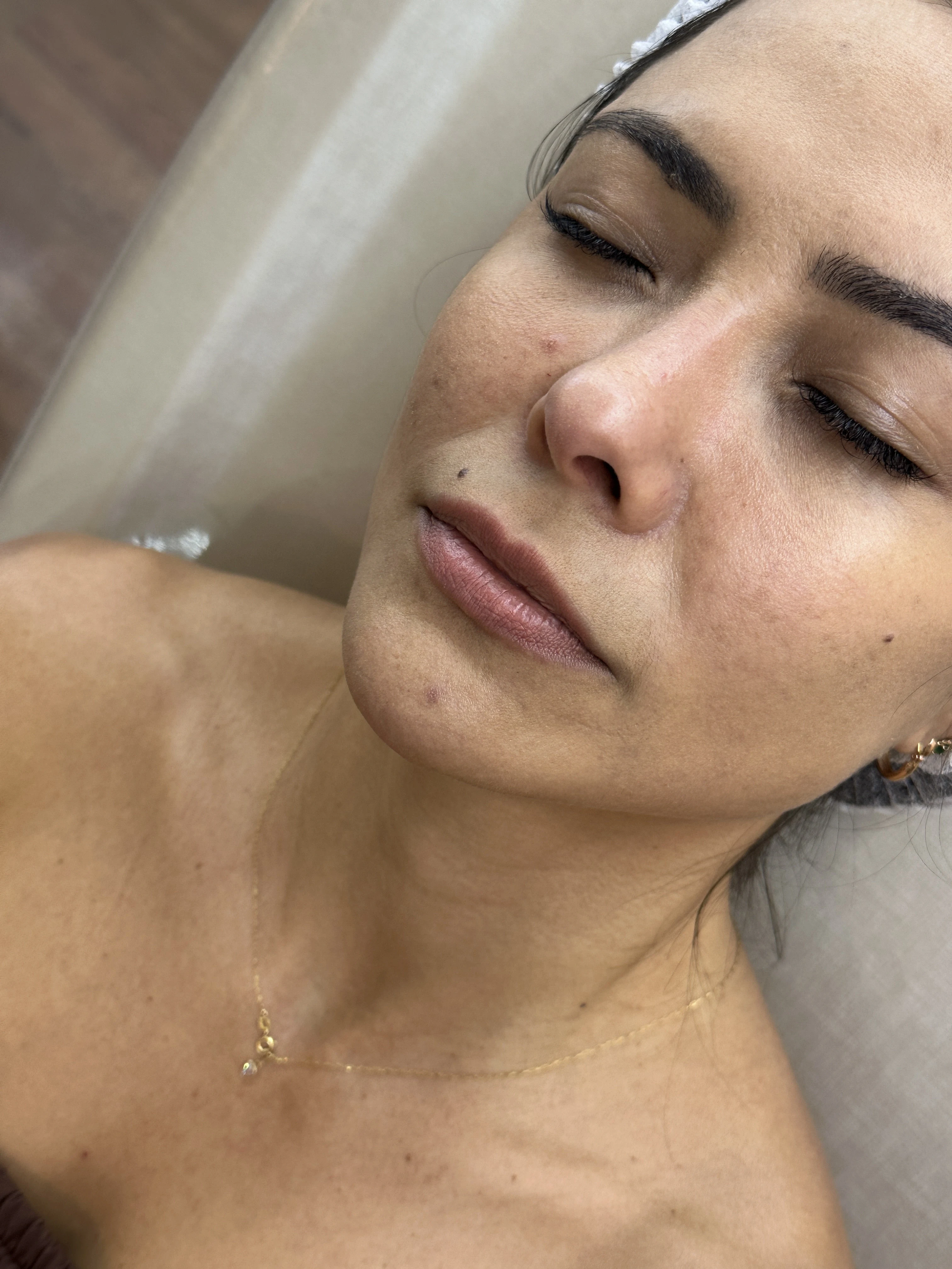 Paciente antes do procedimento